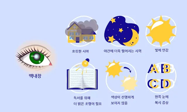 백내장 증상
