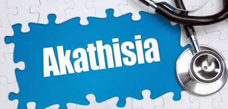 Akathisia disease | Diseasezero