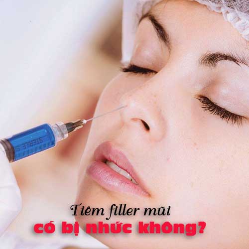 tiêm filler mũi bị nhức