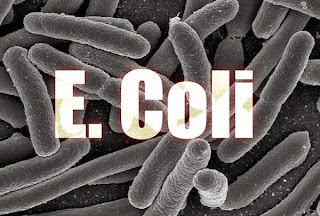 Mengenal Infeksi E. Coli , Gejala , Penyebab , Pengobatan dan Pencegahan
