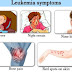 Acute Lymphoblastic Leukemia Symptoms