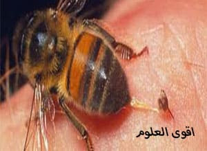 علاج جلالة العين بلسعات النحل
