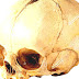 Fontanelle - Human Baby Skull