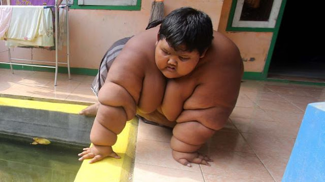 A ten-year-old has been named the world's fattest child, weighs 192