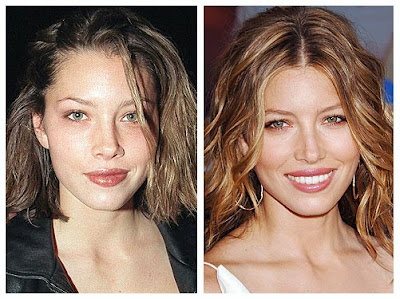 Jessica Biel Nose Job