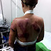 Mujer recibe atenciones médica luego de supuestamente ser golpeada por su pareja