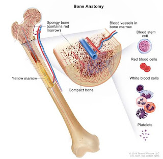 Aplastic anemia