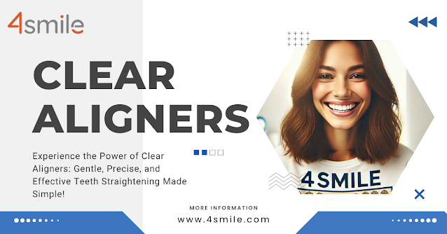 Clear Aligners