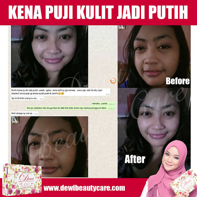 Dewi Beauty Care Skincare Murah