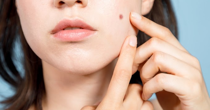 Pimple in Triangle of Death can Kill You!!!