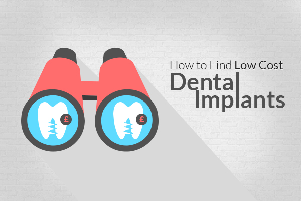 5 Steps to Find Low Cost Dental Implants