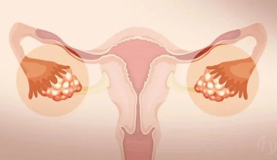 Quais são as Causas Comuns da Cólica Fora do Período Menstrual?