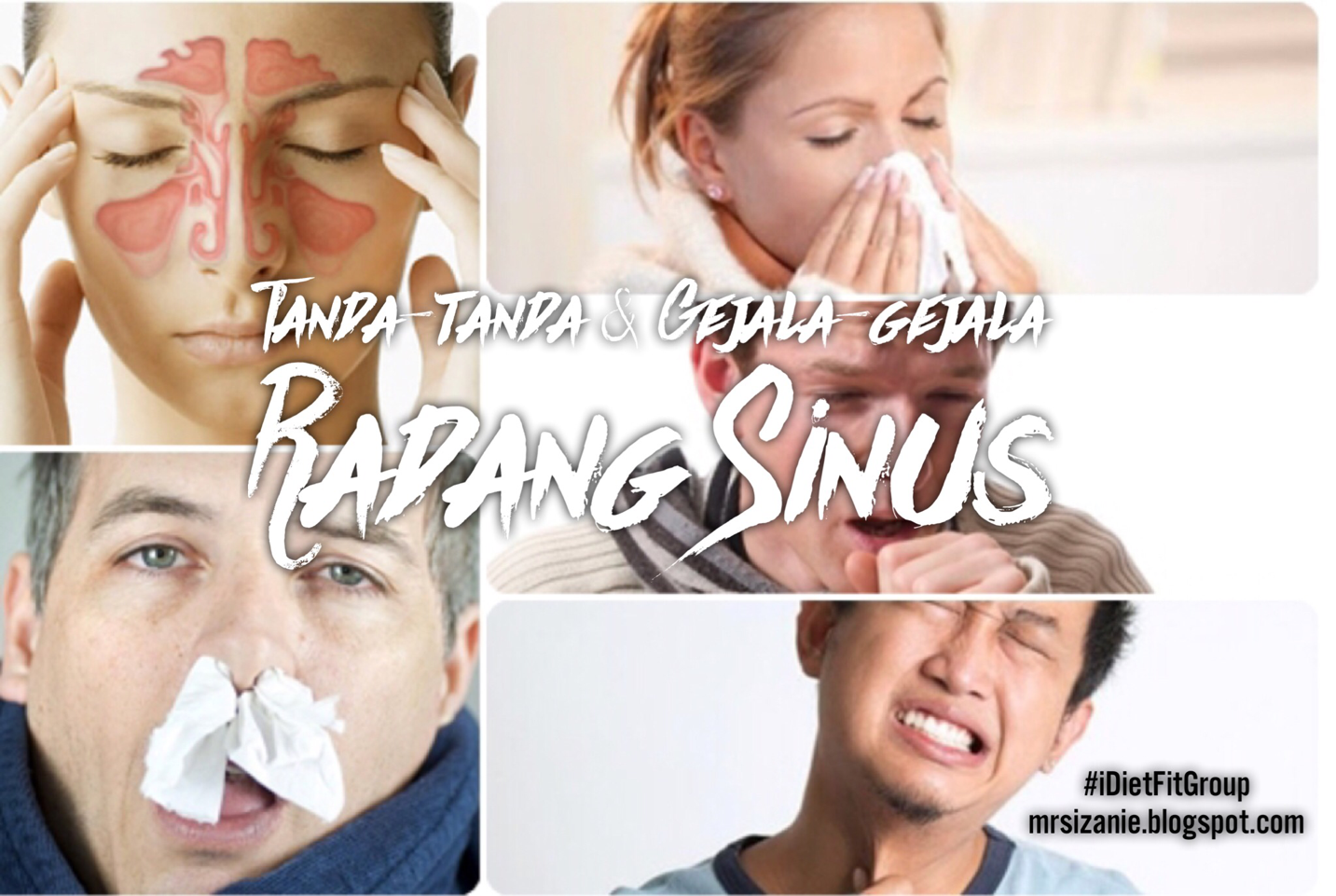 Eat Well.Live Well: TANDA-TANDA DAN GEJALA RADANG SINUS