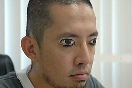 What happens when you no longer want creepy eye tattoos?