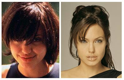 Angelina Jolie Plastic Surgery