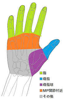 手の5つのパーツ