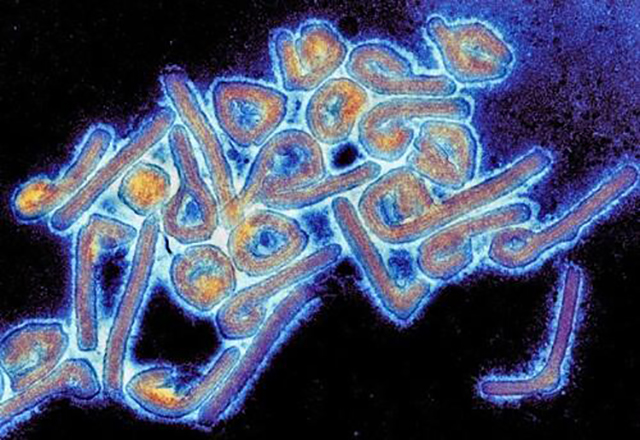 Bioseguridad: Marburg Virus Reverse Genetics Systems