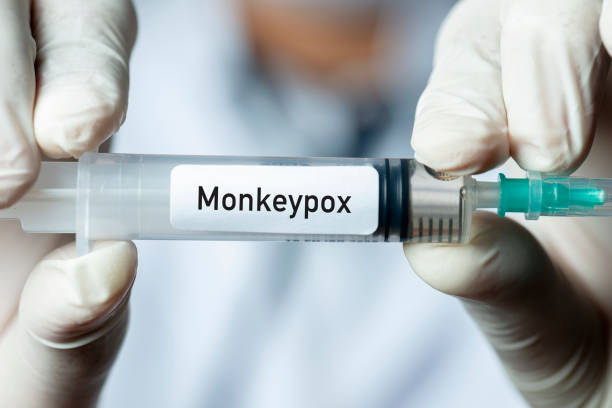 Nota de alerta da Saúde do Ceará sobre notificação de um caso de Monkeypox - Varíola dos Macacos