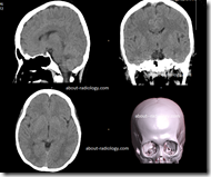 pemeriksaan radiology kepala