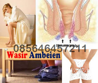 Obat Salep Wasir (Hemoroid) Campuran di Apotik