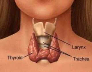 Goiter Causes a Symptoms and Treatment