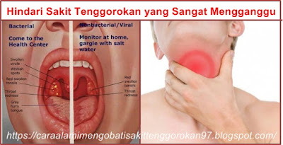 http://caraalamimengobatisakittenggorokan97.blogspot.com/2015/07/cara-alami-mengobati-sakit-tenggorokan.html