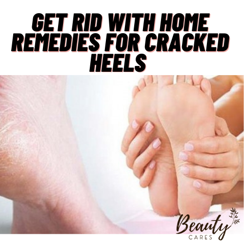 Quick and Easy Remedies for Cracked Heels-hkpdtq2012.edu.vn