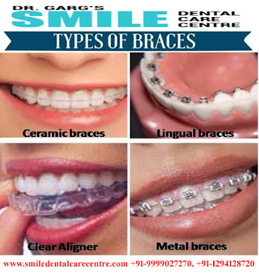 Orthodontic Dental Clinic