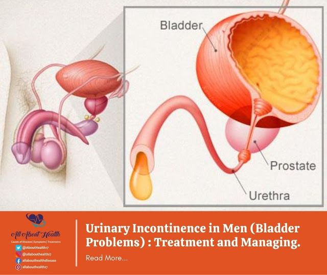 Urinary Incontinence in Men (Bladder Problems) : Treatment and Managing.