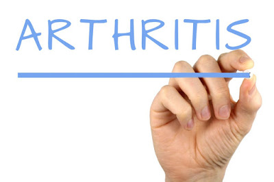 arthritis symptoms