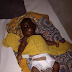 PHOTO see boy that step mother cut off his gental undergoes surgery