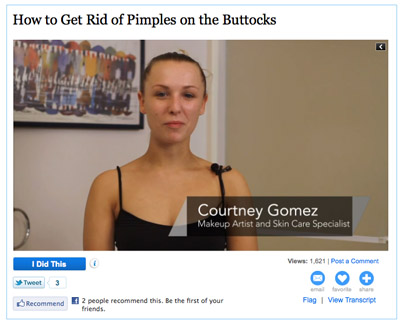 Pimples on the Buttocks"