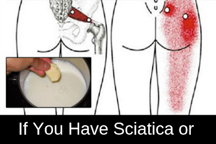 If You Have Sciatica or Back Pain, Take This Remedy and You’ll Never Suffer Again!