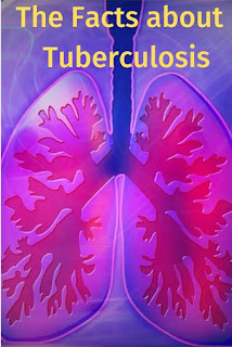 The Facts about the Infectious Disease Tuberculosis