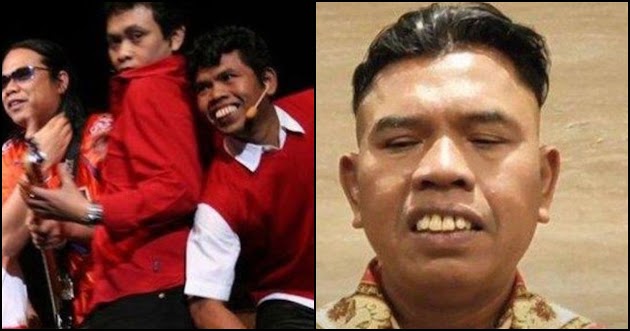 INNALILLAHI, Pelawak Benjo Eks Teamlo Meninggal Dunia, Kaki Mendadak Keram Saat Hendak Pijat hinggga Dilarikan ke ICU