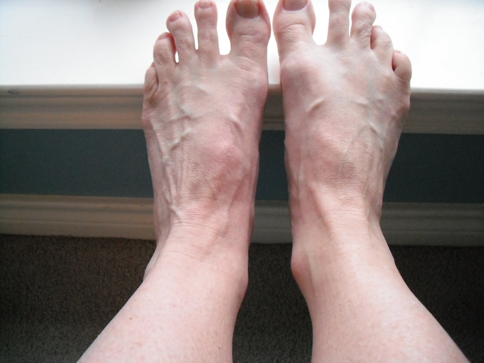 My Journey to Fit January 2011
