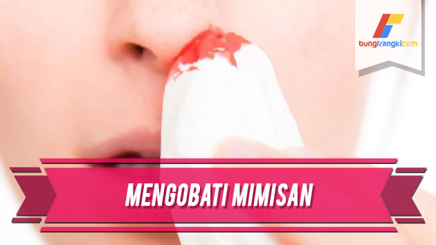 Penyebab Mimisan Serta Cara Mengatasinya