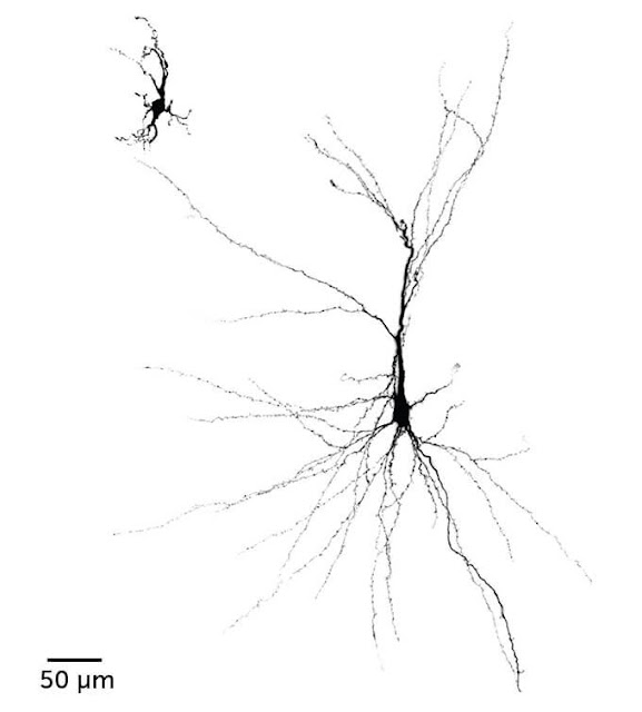 A human nerve cell from an organoid in a rat's brain (right) grew larger and more complex than a similar cell grown in a laboratory dish (left). UNIVERSITY OF STANFORD