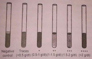 Test for glucosuria, Benedict's test, Aas, alfaaz-e-aas