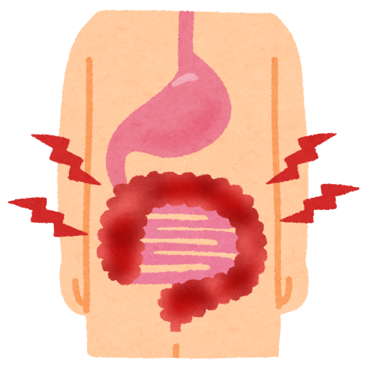 大腸炎のイラスト かわいいフリー素材集 いらすとや