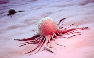 Tế bào ung thư đã chết có thể tự ăn chính mình để sống lại