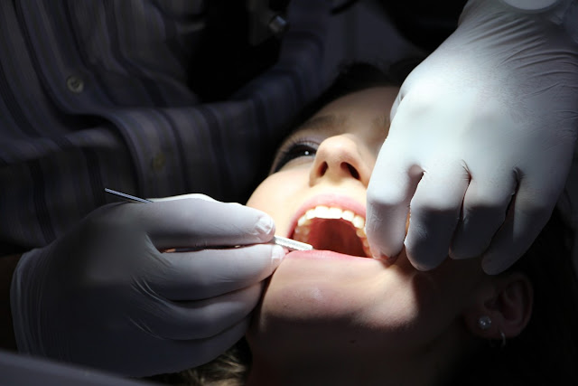 Wisdom Teeth Melbourne