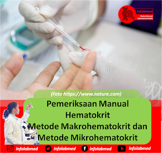 pemeriksaan hematokrit,pemeriksaan hematokrit adalah,pemeriksaan hematokrit pdf,pemeriksaan hematokrit metode mikrohematokrit pdf,pemeriksaan hematokrit metode mikrohematokrit,pemeriksaan hematokrit metode makro,pemeriksaan hematokrit metode mikro,pemeriksaan hematokrit mikro,pemeriksaan hematokrit metode makro dan mikro,pemeriksaan hematokrit metode wintrobe,pemeriksaan hematokrit pada pasien dbd,pemeriksaan hematokrit untuk,pemeriksaan hematokrit ppt,pemeriksaan hematokrit pada ibu hamil,pemeriksaan hematokrit jurnal,pemeriksaan hematokrit darah,pemeriksaan hematokrit metode makro pdf,journal pemeriksaan hematokrit,laporan pemeriksaan hematokrit,tujuan pemeriksaan hematokrit,jurnal pemeriksaan hematokrit pdf,alat pemeriksaan hematokrit,arti pemeriksaan hematokrit