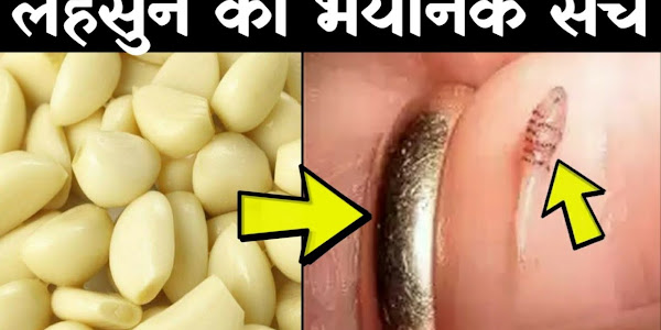 जान लो लहसुन खाने का सही तरीका | Benefits of Garlic