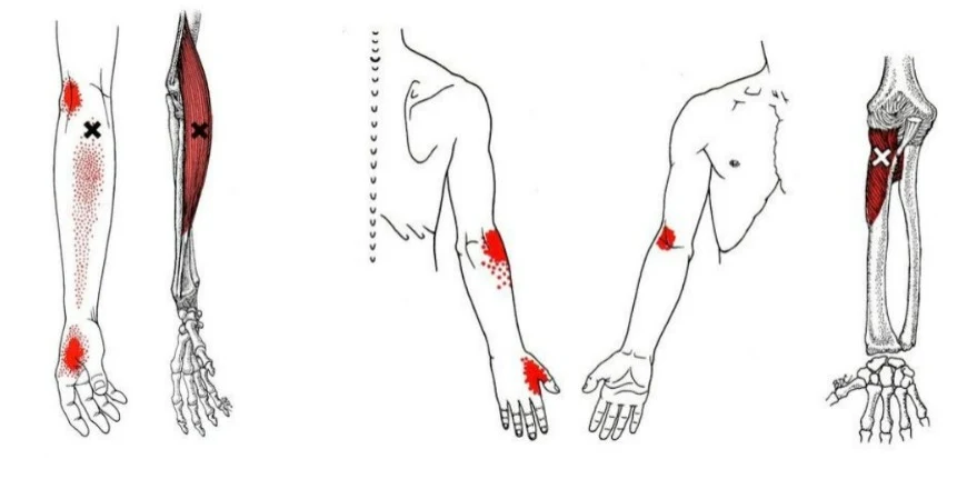 Antebrazo y muñeca - braquiradial y supinador - MCdevservices Spa