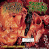 Hydropneumothorax / Septic Autopsy ‎– Chronic Disseases Examiners (Abnormal Putrefaction And Infections)
