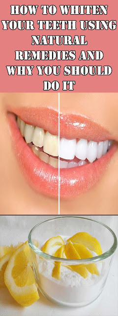 How To Whiten Your Teeth Using Natural Remedies And Why You Should Do It