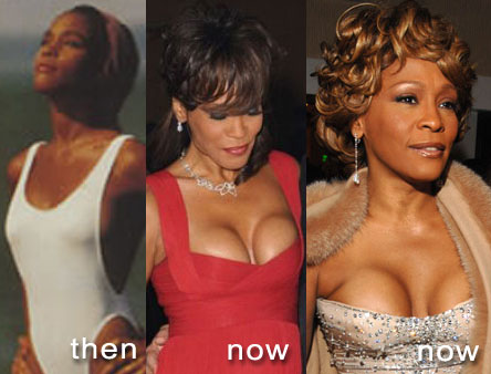 Picture of Whitney Houston before and after breast implants?