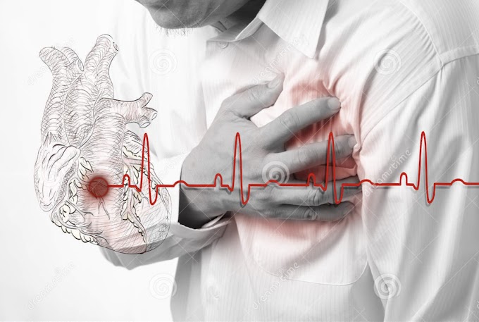 Heart Stroke immediate treatment  || Know ||Explore it