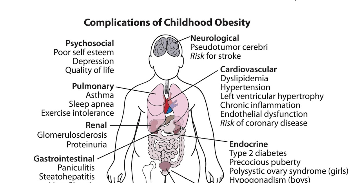 Medical Complications Obesity Childhood